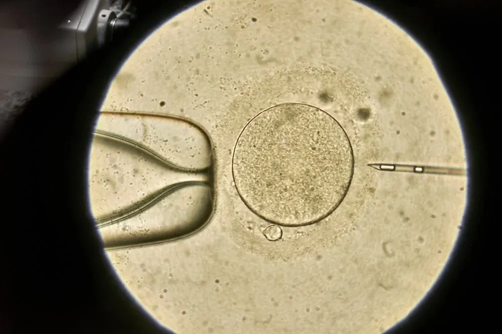 How to Prepare for IVF - A guide for IVF patients